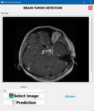 BRAIN TUMOR Classification - Image 2