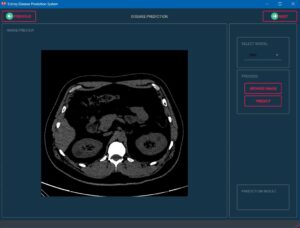 Kidney Disease Prediction using Deep Learning - Image 4